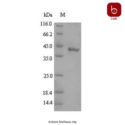 [CusaBio] Recombinant Porphyromonas gingivalis Gingipain R2(rgpB), partial